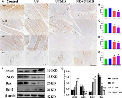 Ultrasound-Induced Destruction of Nitric Oxide–Loaded Microbubbles in the Treatment of Thrombus and Ischemia–Reperfusion Injury